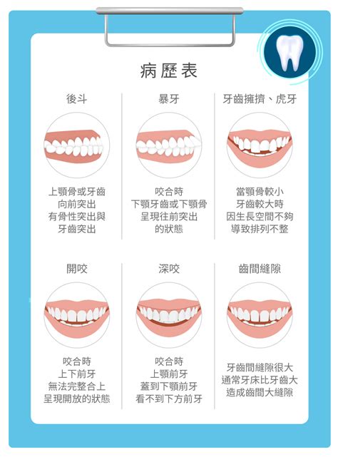 上下排牙齒平行|戽斗矯正：上下排牙齒咬合問題與預防方法